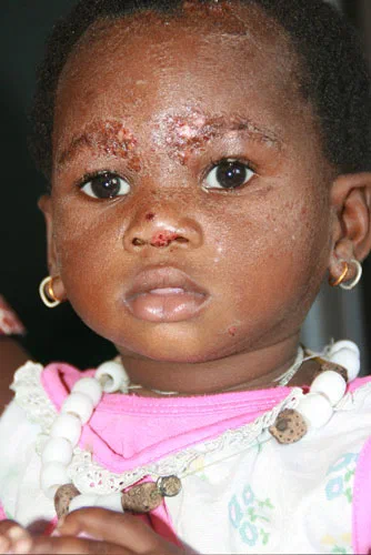 Portrait d’un jeune enfant pendant la mission au Sénégal.